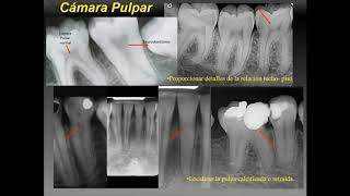 técnicas radiográficas en endodoncia [upl. by Ainek129]